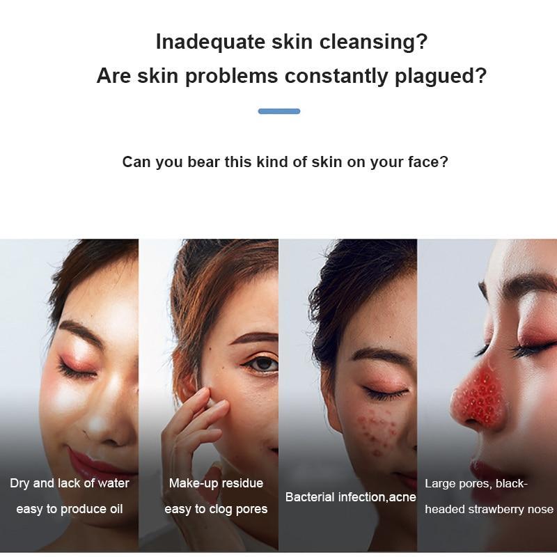 Electric Blackhead Vacuum Remover - Buyerana