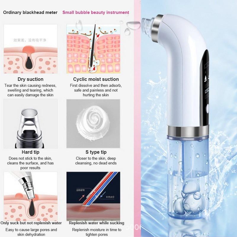 Electric Blackhead Vacuum Remover - Buyerana